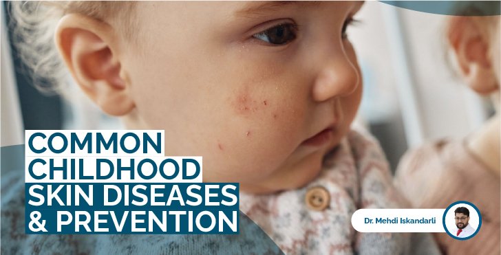 Common Childhood Skin Diseases in Baku & How Parents Can Prevent Them